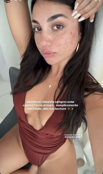Anna Gegnoso
