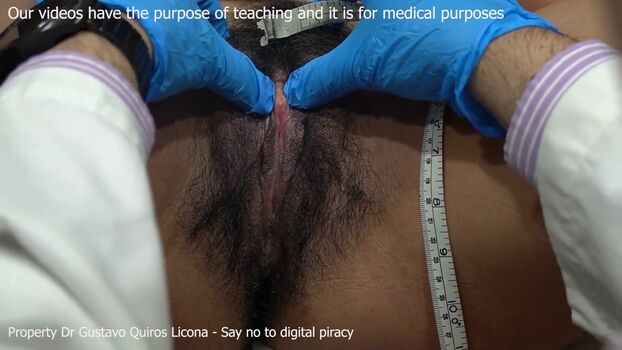 Full leaked Dr gustavo quiros licona private onlyfans photo