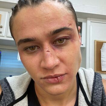 Full leaked Katy o brian private onlyfans photo