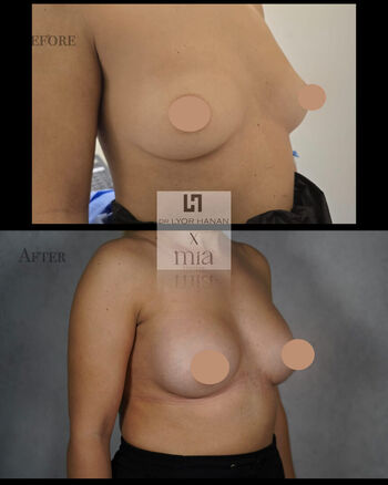 Full leaked Miafemtech private onlyfans photo