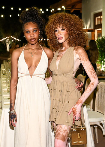 Full leaked Winnie harlow private onlyfans photo